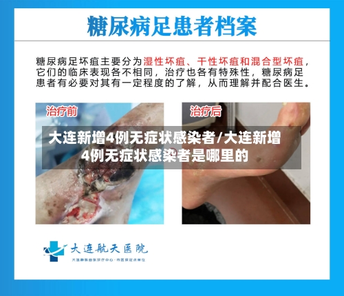 大连新增4例无症状感染者/大连新增4例无症状感染者是哪里的