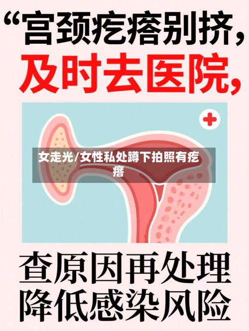 女走光/女性私处蹲下拍照有疙瘩