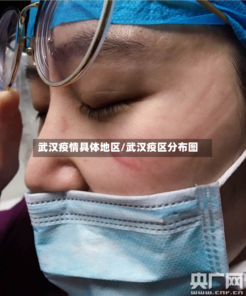 武汉疫情具体地区/武汉疫区分布图-第2张图片