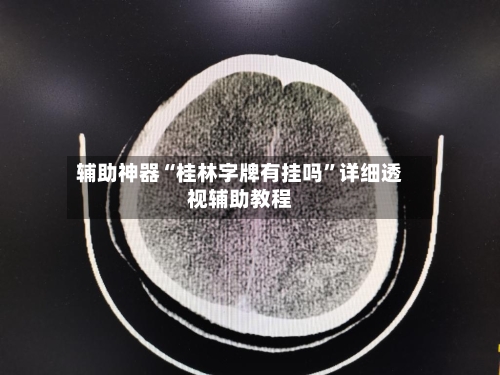 辅助神器“桂林字牌有挂吗	”详细透视辅助教程-第3张图片