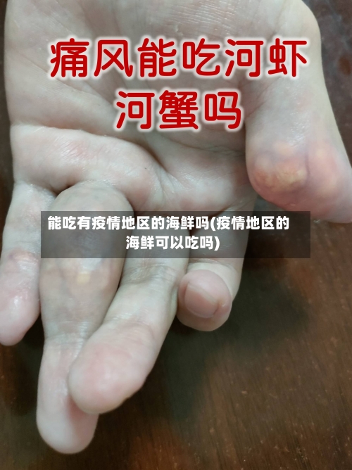 能吃有疫情地区的海鲜吗(疫情地区的海鲜可以吃吗)